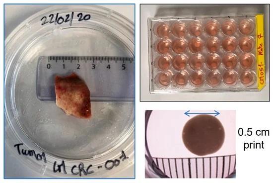 科學家3D生物打印可長期存活的腫瘤模型
